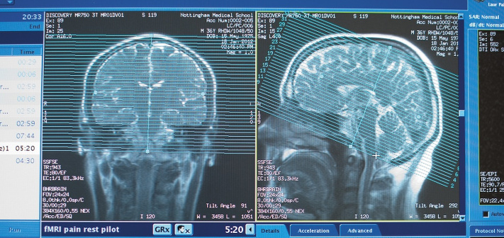 computational-neuroscience
